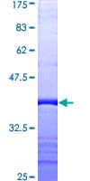 Human PDCD6IP / ALIX Protein (Recombinant GST, N-terminus)