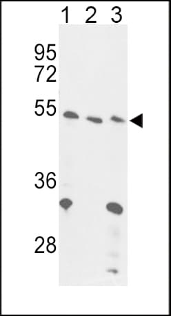 Polyclonal Rabbit anti-Human FOXP3 Antibody (aa283-311, IHC, WB)
