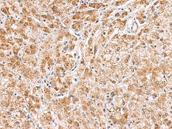 HMGCLL1 Antibody