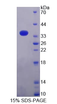 Human TUBB1 / Tubulin Beta 1 Protein (Recombinant His-T7)