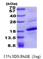 Human MLANA / Melan-A Protein (Recombinant His)