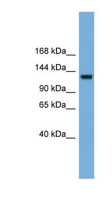 RASGRF1 / CDC25 Antibody (aa467-516)