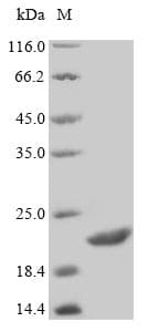 Human CD19 Protein (Recombinant 6His, C-terminus)