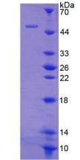 Rabbit COL2A1 / Collagen II Alpha 1 Protein (Recombinant His-GST-S)