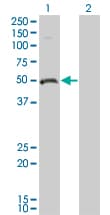 ODC1 / Ornithine Decarboxylase Antibody (clone 2G5)