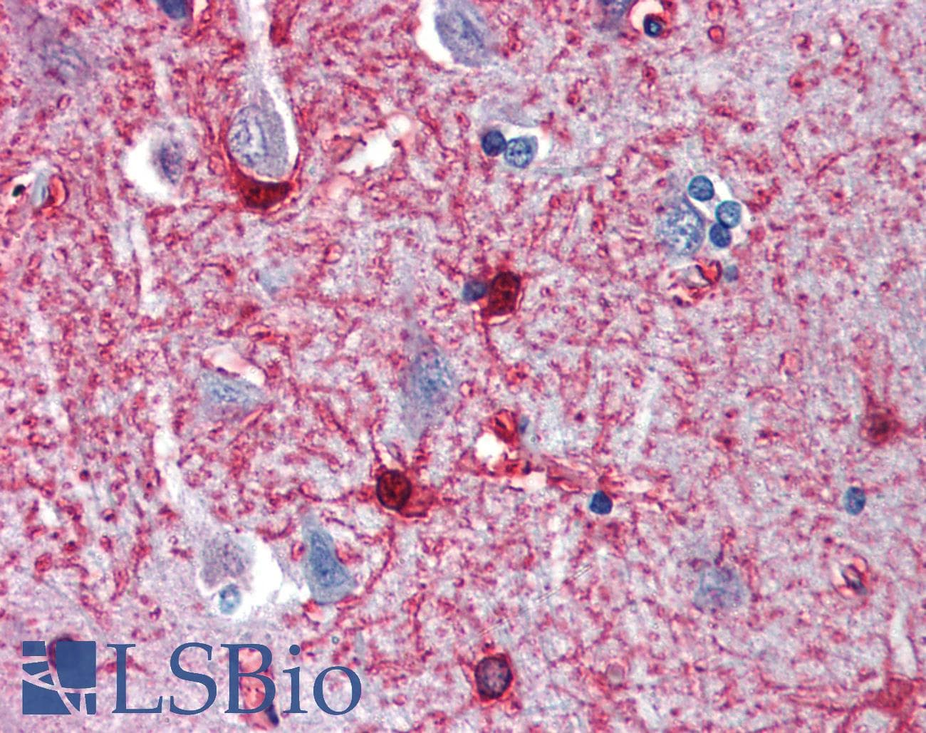 PathPlus™ Polyclonal Rabbit anti-Human ENO1 / Alpha Enolase Antibody (aa246-295, IHC, WB)