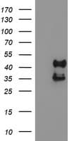 Monoclonal Mouse anti-Human PDSS2 / DLP1 Antibody (clone OTI1E9, IHC, IF, WB)