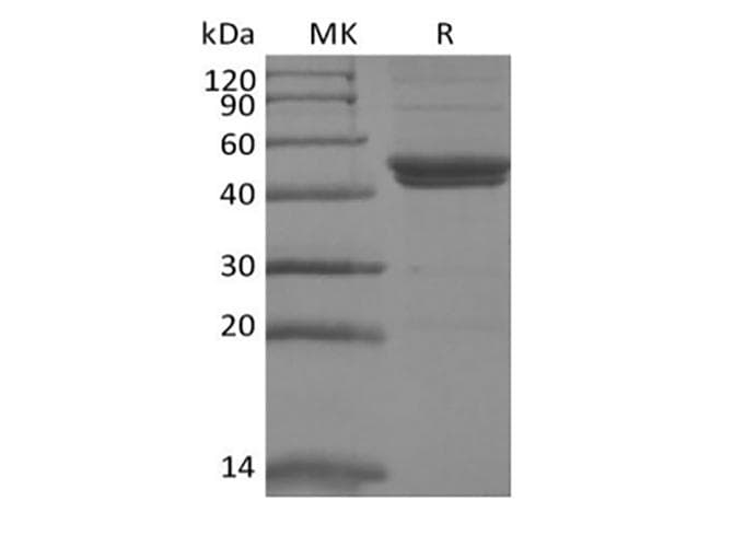 Mouse IL11RA Protein (Recombinant 6His, C-terminus)