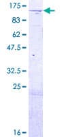 Human CAP-G2 / MTB Protein (Recombinant GST)