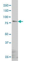 Monoclonal Mouse anti-Human GLB1 / Beta-Galactosidase Antibody (clone 6E7, WB)