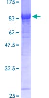 Human GAD65 Protein (Recombinant GST)