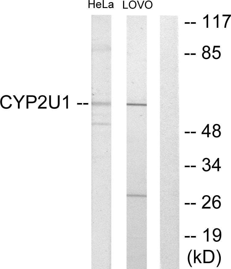 CYP2U1 Antibody