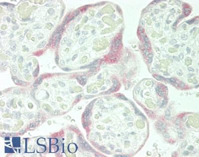 IHC-plus™ FST / Follistatin Antibody (aa114-163)