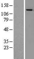 KDM4A / JHDM3A / JMJD2A Protein (Over-Expression Lysate Myc-DDK (Flag))