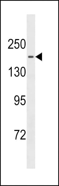 TTBK1 Antibody (aa667-695)