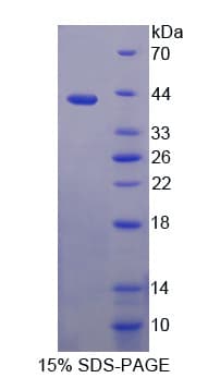 Human ADAP2 / CENTA2 Protein (Recombinant His-T7)