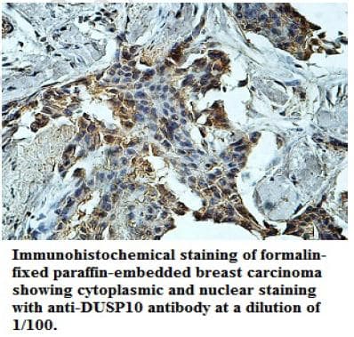 DUSP10 / MKP5 Antibody (aa288-482)