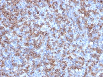 CD8A / CD8 Alpha Antibody (clone C8/1779R, Azide-free, Carrier-free)