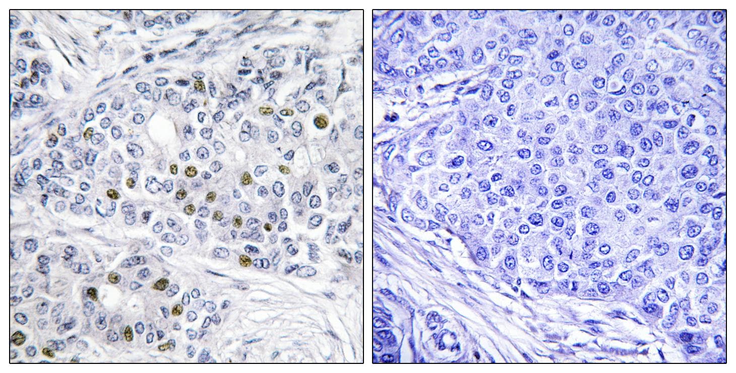 RB1 / Retinoblastoma / RB Antibody