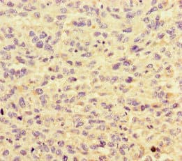 HNRNPF / hnRNP F Antibody