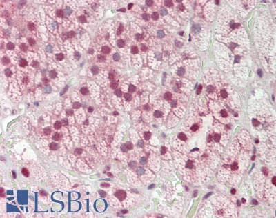 IHC-plus™ Polyclonal Rabbit anti-Human RAD50 Antibody (aa700-750, IHC)