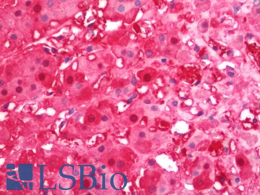 IHC-plus™ RDX / Radixin Antibody (aa142-191)