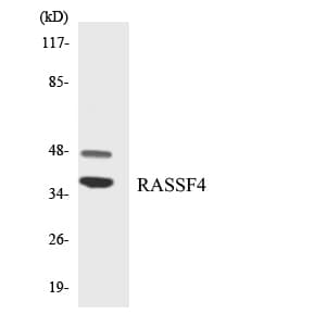 AD037 / RASSF4 Antibody (aa117-166)