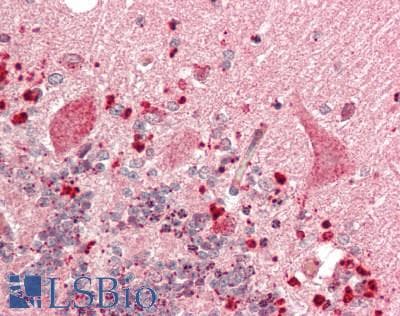 IHC-plus™ FAT1 / FAT Antibody (aa4450-4500)