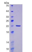 Human Prostaglandin D Synthase Protein (Recombinant His-T7)