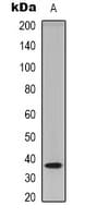 TECR / TER Antibody (C-Terminus)