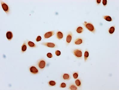 HIST1H2BN Antibody