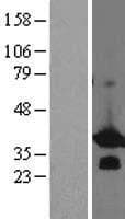 BCL7B Protein (Over-Expression Lysate Myc-DDK (Flag))