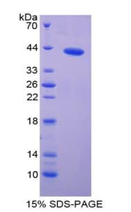 Mouse GAD1 / GAD67 Protein (Recombinant His-GST)