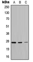 ATPASE6 / ATP6 Antibody (Internal)