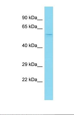 Polyclonal Rabbit anti-Human NAB2 Antibody (N-Terminus, WB)