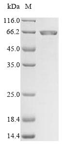 Mouse MMP24 Protein (Recombinant 10His, N-terminus + Myc, C-terminus)