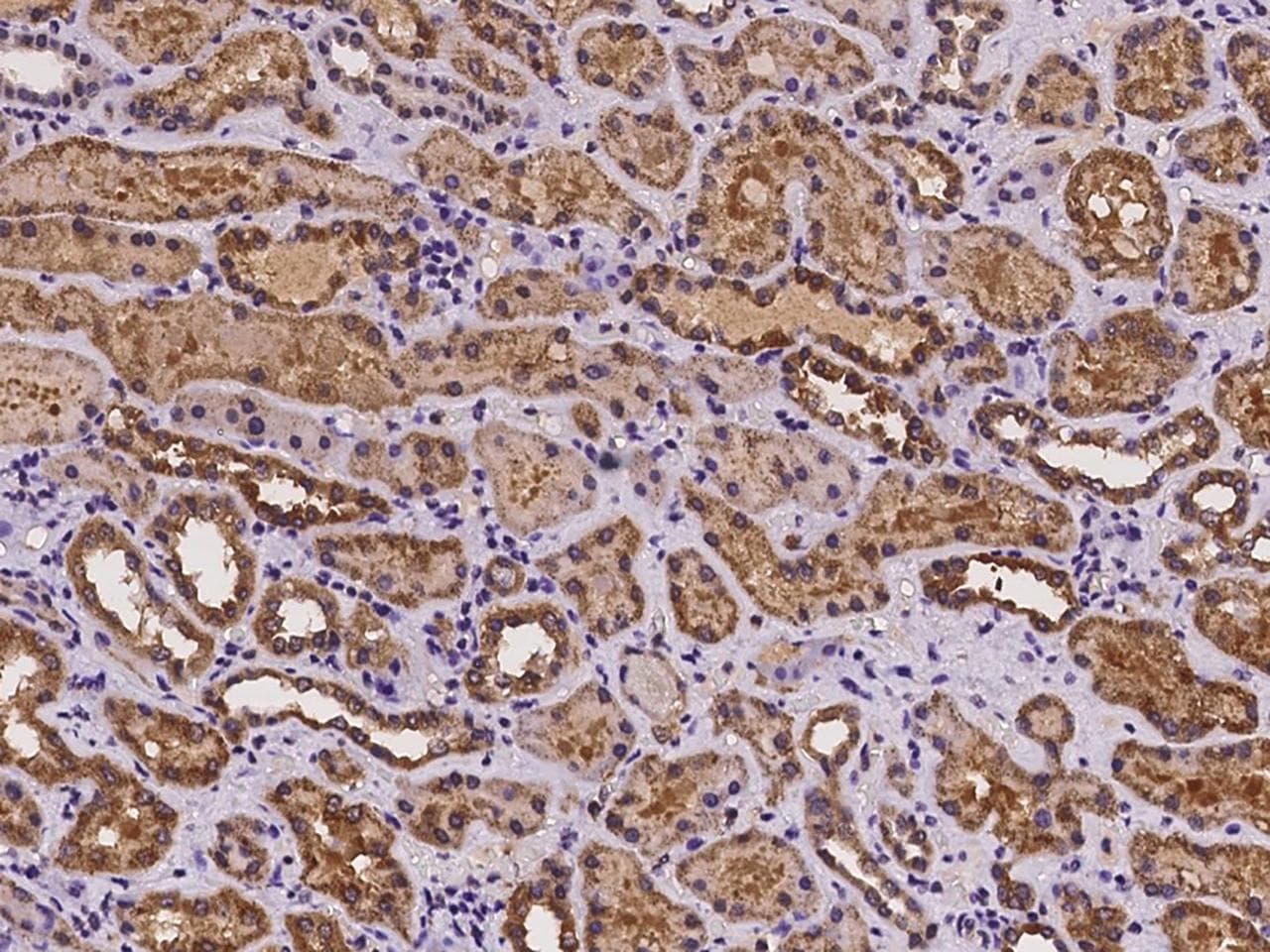 CRISPLD1 Antibody