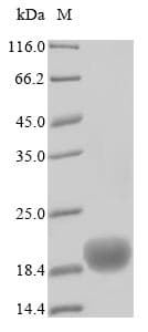 Human CD52 Protein (Recombinant 6His, N-terminus)