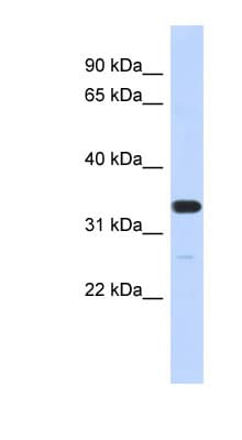 FAM76A Antibody (N-Terminus)