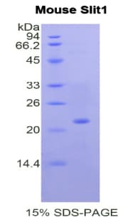 Mouse SLIT1 Protein (Recombinant His)