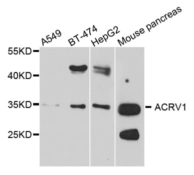 Polyclonal Rabbit anti-Human ACRV1/Intra-Acrosomal Protein Antibody (WB)