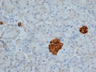 Monoclonal Mouse anti-Human CHGA / Chromogranin A Antibody (clone LK2H10, IHC, WB)