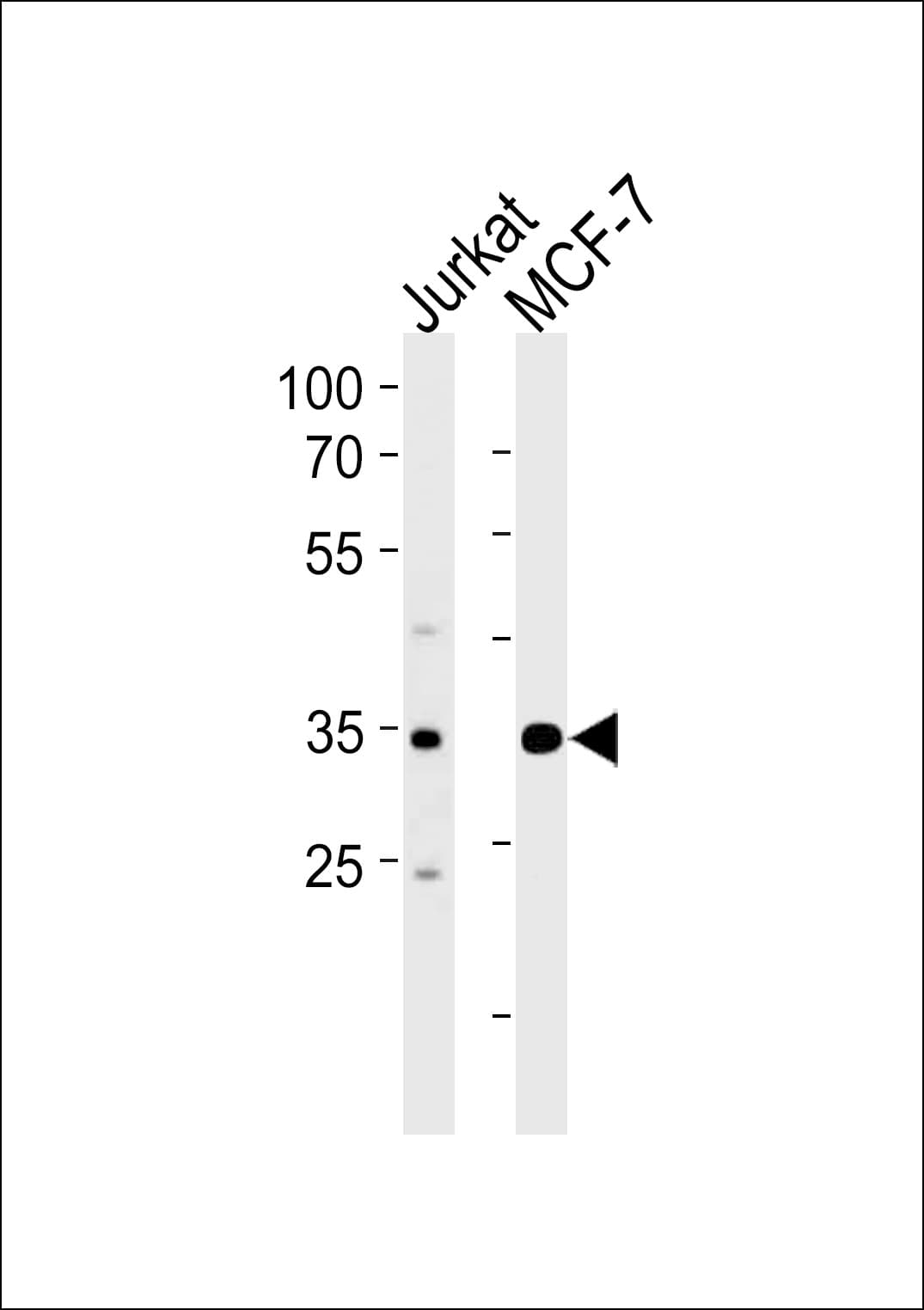 Polyclonal Rabbit anti-Human ATF4 Antibody (aa171-198, WB)