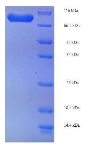 Human PGM1 / Phosphoglucomutase 1 Protein (Recombinant His-SUMO)