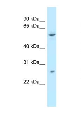 TTC39B Antibody (aa378-427)