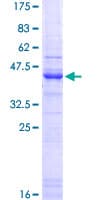 Human HSPG2 / Perlecan Protein (Recombinant GST, N-terminus)