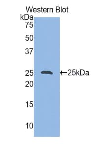 HSPB1 / HSP27 Antibody (aa1-209)