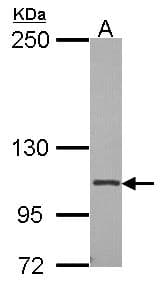 Polyclonal Rabbit anti-Human ITGA2B / CD41 Antibody (aa210-532, IHC, WB)