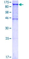 Human PDCD6IP / ALIX Protein (Recombinant GST)