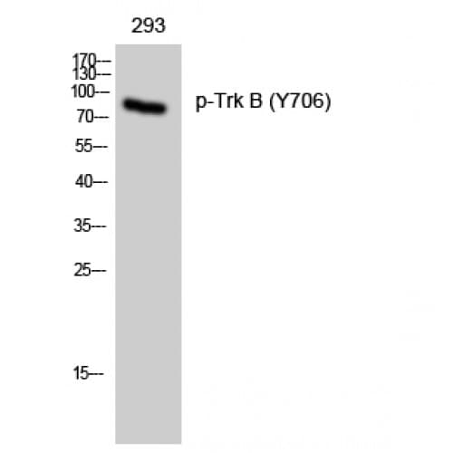 Polyclonal Rabbit anti-Human NTRK2 / TRKB Antibody (640-720 aa, IHC, IF, WB)